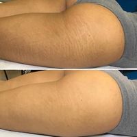 nota105727_imagen109886_1